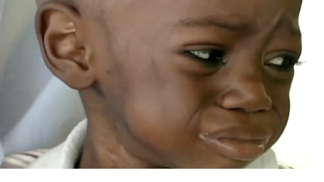 Unicef say di moni no reach to treat all di pikin dem