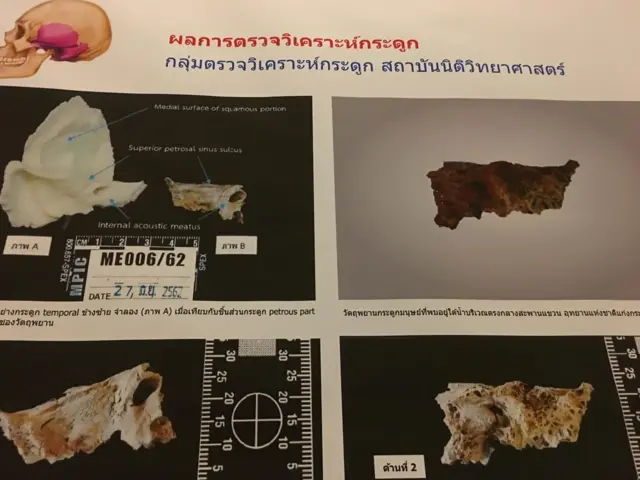 ชิ้นส่วนกระดูกมนุษย์ที่พบเป็นส่วนกะโหลกศีรษะด้านท้ายทอยค่อนมาทางด้านหู มีรอยแตกร้าวและรอยไหม้