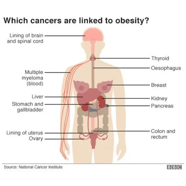कॅन्सरचे प्रकार