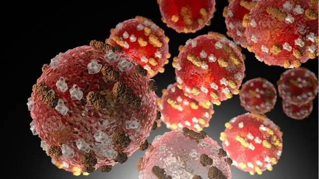 Coronavirus, dengue y sarampión: la peligrosa combinación en América Latina  de 3 epidemias cuyos síntomas pueden confundirse - BBC News Mundo