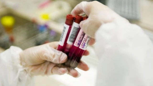 การตรวจหาค่าของตัวบ่งชี้ทางชีวภาพ (biomarkers) หลายชนิด ทำให้ทราบถึงรูปแบบของความชราที่เราเผชิญอยู่ได้