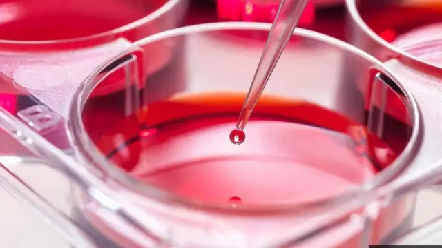 पेशी, कोरोना, साथीचे आजार