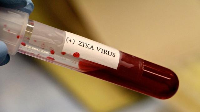 Amostrajogos online gratis que ganha dinheirosangue com etiqueta zika