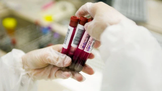 วิธีการตรวจโปรตีนในเลือด เพื่อหาอายุที่แท้จริงของอวัยวะต่าง ๆ อาจพร้อมใช้งานได้จริงในอีก 5-10 ปีข้างหน้า