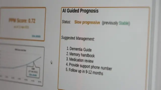 Résultat de tomographie cérébrale