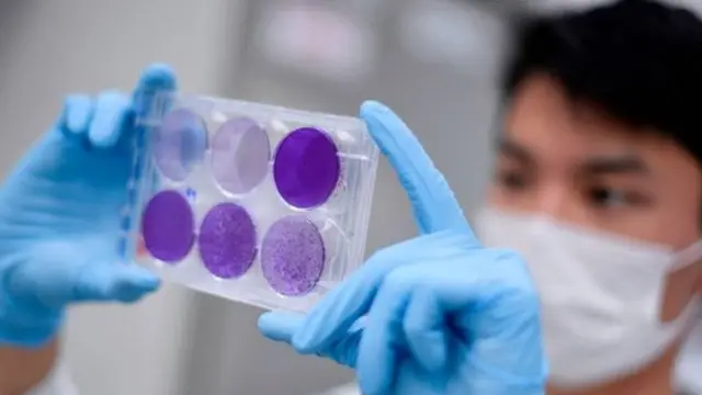 له ۴۰ ډېرو پروژو کې د کوويډ ۱۹ لپاره د واکسین لټون کېږي