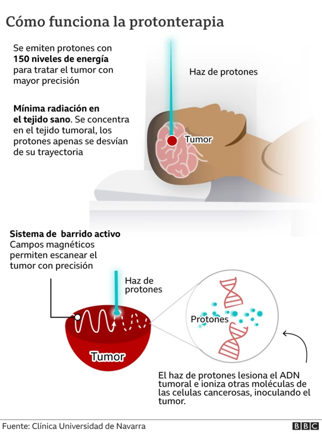 Protonterapia