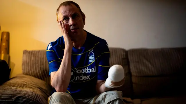 Стивен Крин: человек в футболке его футбольного клуба, на его руке видна большая повязка