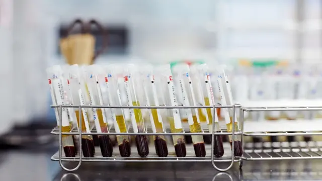 Primer plano de un tubo de ensayo de muestras médicas en un laboratorio.