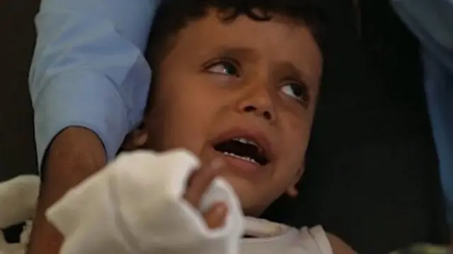 ஏமன், ஹூதி கிளர்ச்சியாளர்கள், போர், குழந்தைகள் 