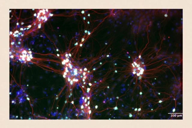 Các công ty như Cortical Systems đang làm việc với các "mô não nhân tạo" do các tế bào thần kinh tạo thành