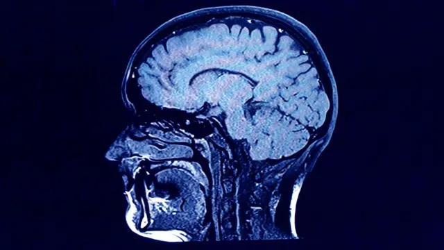 ¿Producimos nuevas neuronas en la vida adulta? El pico de la bomba ha ayudado a proporcionar respuestas.