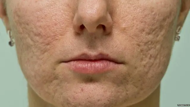 ምስ ፈጸጋ ምቅላስ ከቢድ ክኸውን ይኽእል እዩ