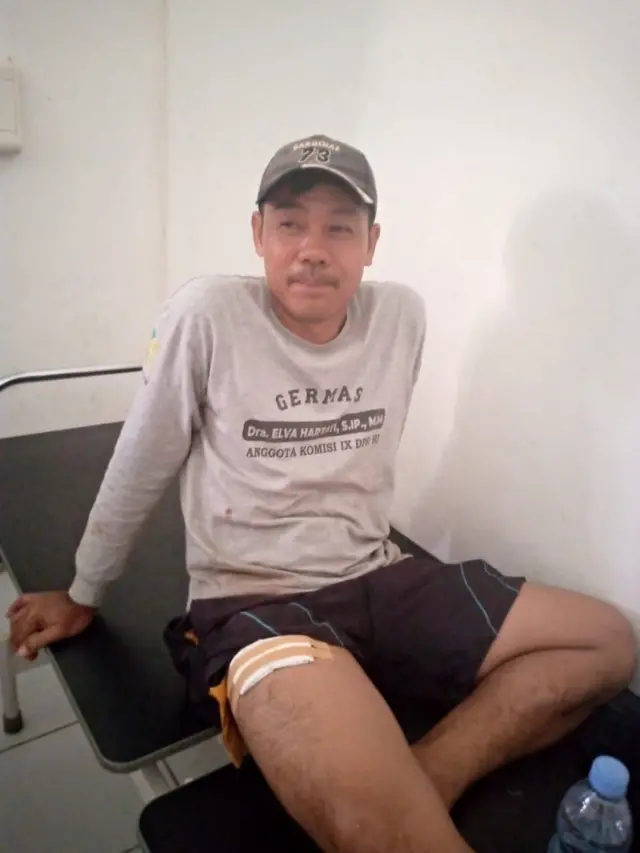 Edi Hermanto duduk di ranjang rumah sakit dengan perban yang masih menempel di pahanya.