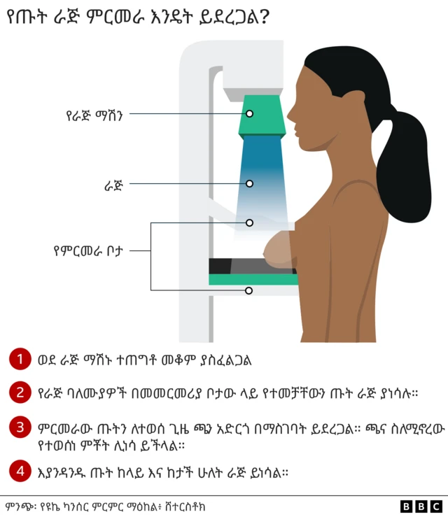 የጡት ካንሰር መመርመሪያ ራጅ