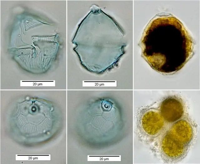 Vue microscopique de la microalgue