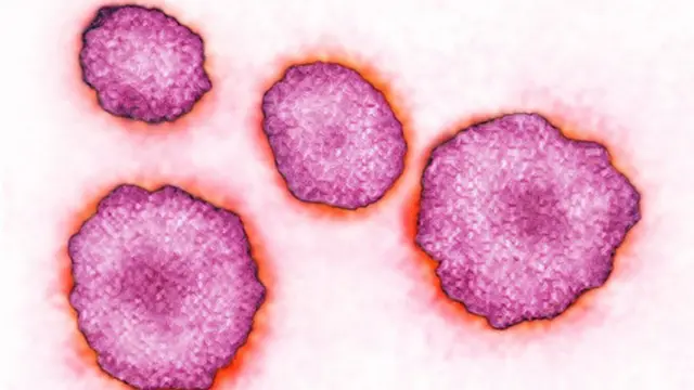 ગાલપચોળિયાં