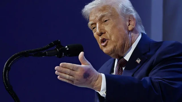 Cиняк был виден на руке Трампа, когда он выступал на Всемирном экономическом форуме в Давосе в этом году