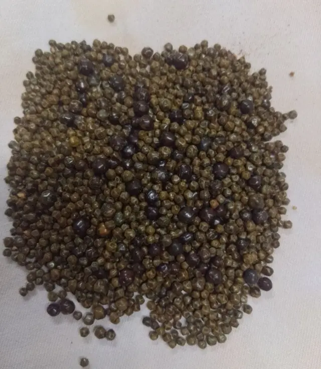 የወጣው የሐሞት ጠጠር 