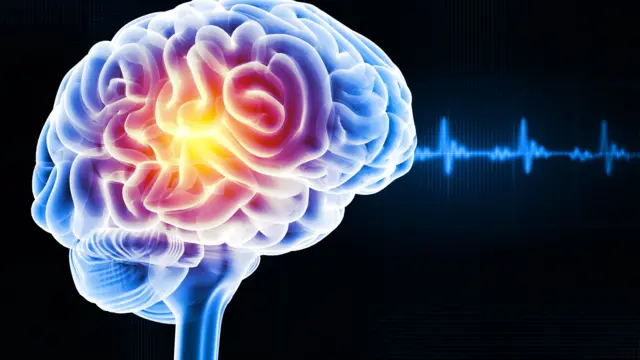 ਮਾਈਗ੍ਰੇਨ