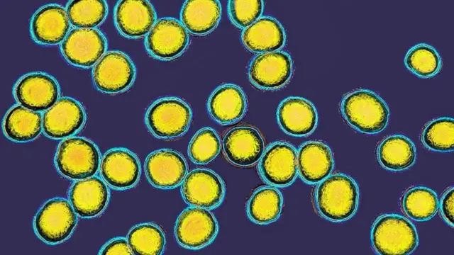 Золотистий стафілокок - бактерія, яка, як вважають, причетна до розвитку деяких шкірних захворювань