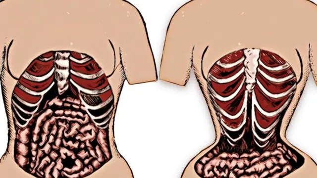 Ihe 'waist trainer' na-eme ndị yiri ya