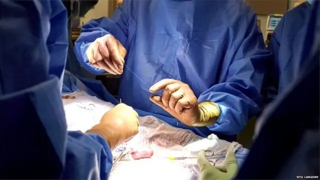 प्रातिनिधिक फोटो