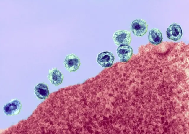 एचआईभी सङ्क्रमण हुँदा कोष यस्तो देखिन्छ