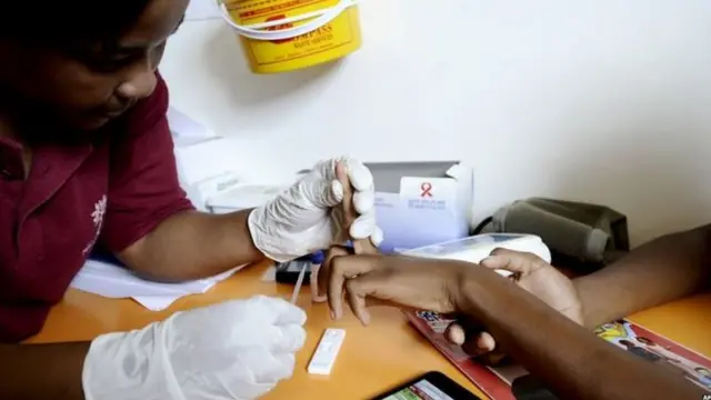 HIV TEST