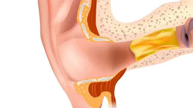 تصویرسازی از داخل گوش
