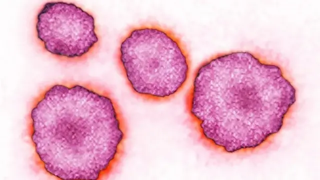 Virus gondongan dapat ditularkan melalui air liur atau tetesan.