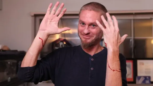 ইউটিউব ভিডিওতে টিম ফ্রেডি দেখাচ্ছেন সাপের কামড়ের প্রভাব কেমন হয়