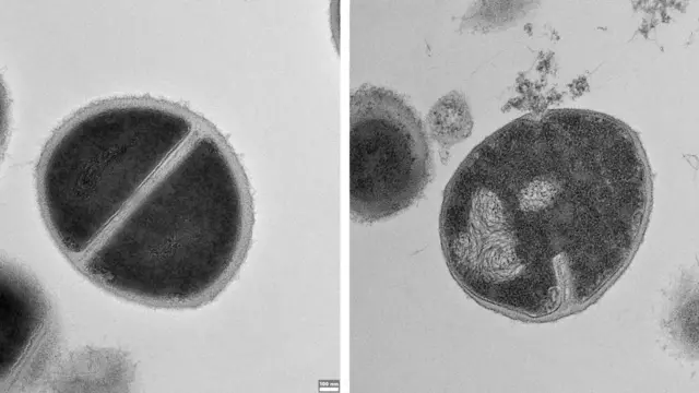 Bakterije stafilokoka, jedna zdrava sa leve strane, a jedna je uništena jer je njen spoljašnji sloj pocepan antimikrobnim sredstvima koje proizvodi proteazom.