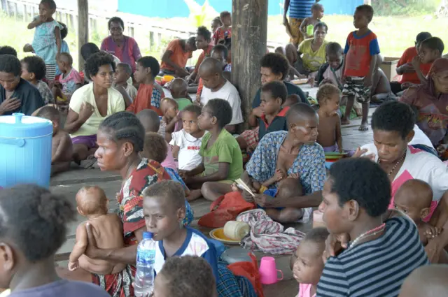 Gizi buruk, Asmat, Papua 