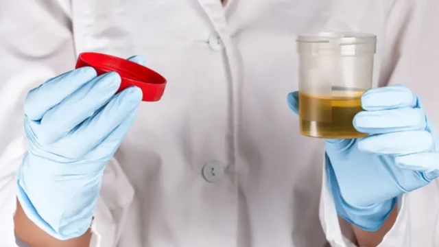 உடல்நலம்: ஆபத்தைக் குறிக்கும் சிறுநீரின் நிறம் - எப்போது எச்சரிக்கையாக இருக்க வேண்டும்?