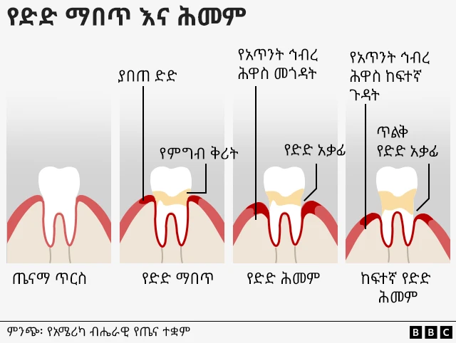 የጥርስ እና ድድ ምሥል
