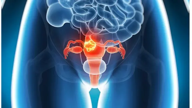 ગર્ભાવશય