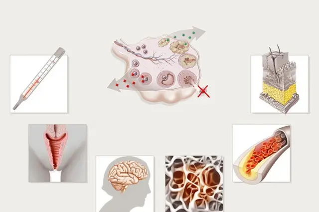 మెనోపాజ్ లక్షణాలు