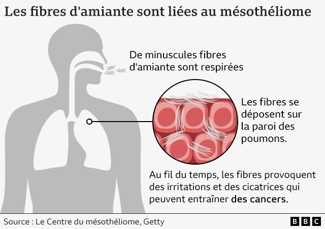 Graphique montrant comment les fibres d'amiante peuvent endommager les poumons.