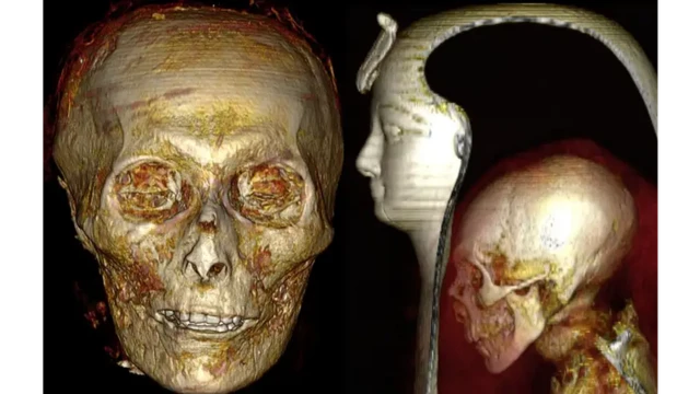 ภาพสแกนกะโหลกศีรษะของฟาโรห์อาเมนโฮเทปที่ 1 (ขวา) ภาพสแกนโครงกระดูกภายใต้หน้ากากและผ้าพันร่าง