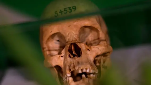 جمجمة بشرية