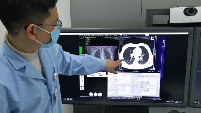 Intanet mai karfin 5G ya taimaka wajen binciken lafiyar masu coronavirus cikin sauri a China