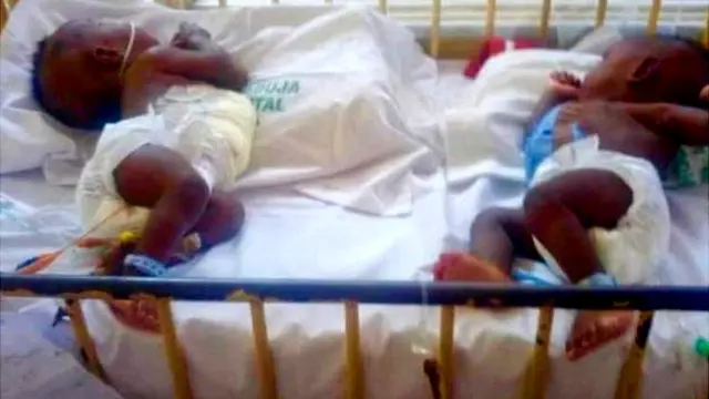 Gutandukanya aba bana ngo ni igikorwa cyamaze amasaha menshi