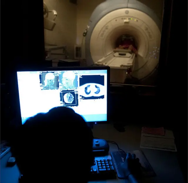 స్కానింగ్