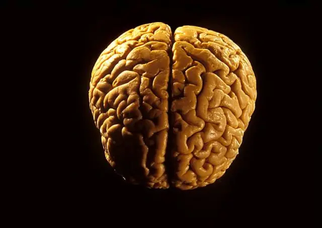 brain