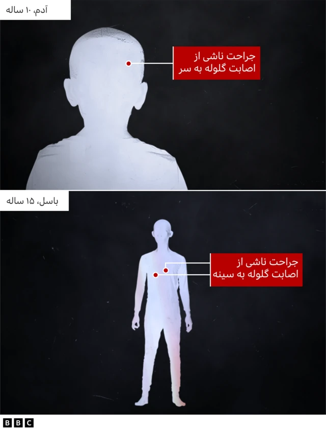 اصابت به سر و سینه