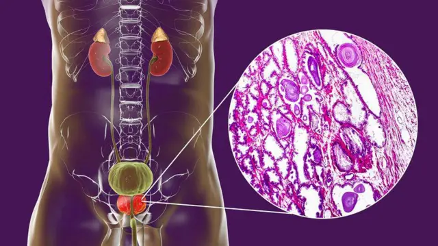 Anatomia da próstata