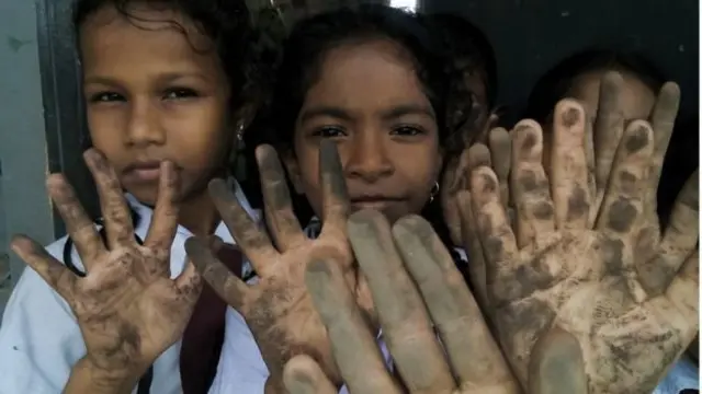 නොරෝච්චෝලේ ගල් අඟුරු බලාගාරය අවට දරුවන්ට චර්ම රෝග වැළඳී ඇති අන්දම පසුගියදා බීබීසී සිංහල සේවය අනාවරණය කළේය