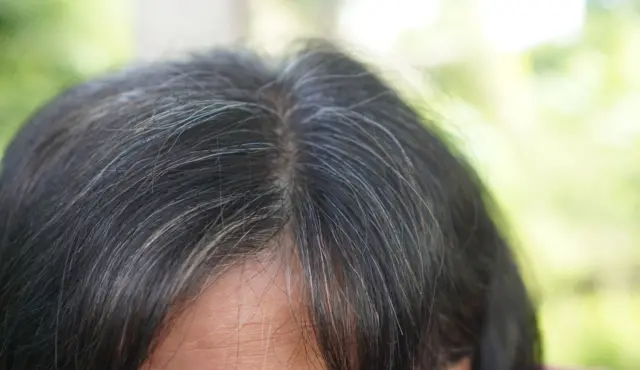 सफ़ेद बाल