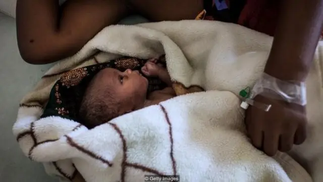 'A C-section is just a second way of delivering'